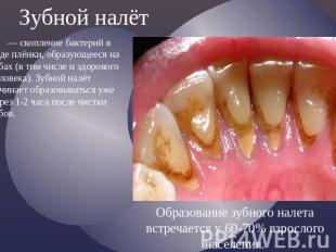 Зубной налёт — скопление бактерий в виде плёнки, образующееся на зубах (в том чи