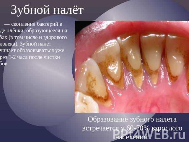 Зубной налёт — скопление бактерий в виде плёнки, образующееся на зубах (в том числе и здорового человека). Зубной налёт начинает образовываться уже через 1-2 часа после чистки зубов.