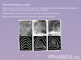 Типы папиллярных узоров: А) петлевые (встречаются в 65 % случаев), характеризующ