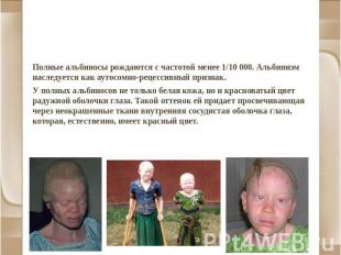 Альбинизм и другие нарушения пигментации Полные альбиносы рождаются с частотой м