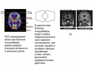 PET-сканирование мозга при болезни Альцгеймера демонстрирует угасание активности