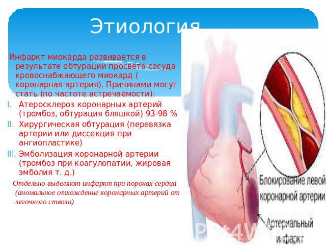 Этиология Инфаркт миокарда развивается в результате обтурации просвета сосуда кровоснабжающего миокард (коронарная артерия). Причинами могут стать (по частоте встречаемости):Атеросклероз коронарных артерий (тромбоз, обтурация бляшкой) 93-98 %Хирурги…
