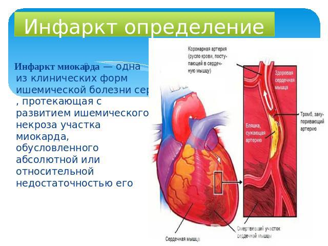 Инфаркт определение Инфаркт миокарда — одна из клинических форм ишемической болезни сердца, протекающая с развитием ишемического некроза участка миокарда, обусловленного абсолютной или относительной недостаточностью его кровоснабжения.
