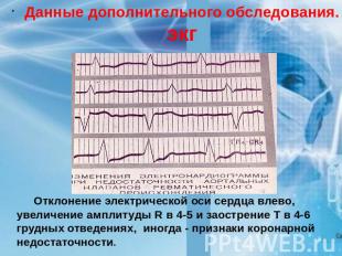 Данные дополнительного обследования. экг Отклонение электрической оси сердца вле