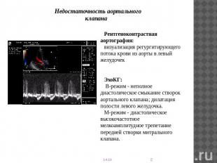 Недостаточность аортального клапана Рентгеноконтрастная аортография: визуализаци