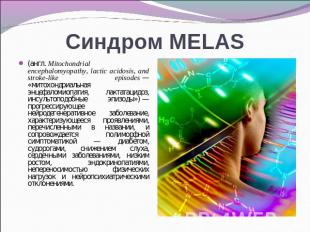 Синдром MELAS (англ. Mitochondrial encephalomyopathy, lactic acidosis, and strok