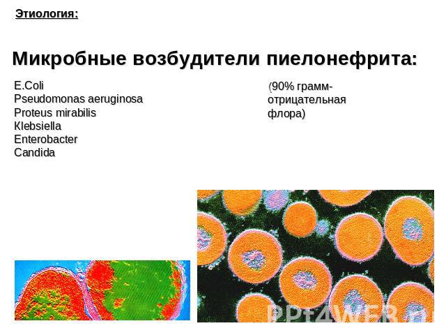 Этиология: Микробные возбудители пиелонефрита: E.ColiPseudomonas aeruginosaProteus mirabilisКlebsiellaEnterobacterCandida(90% грамм-отрицательнаяфлора)