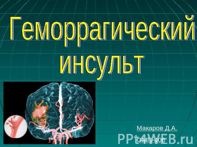 Геморрагический инсульт Макаров Д.А.ОМП-406
