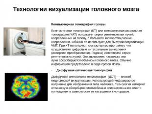 Технологии визуализации головного мозга Компьютерная томография головыКомпьютерн