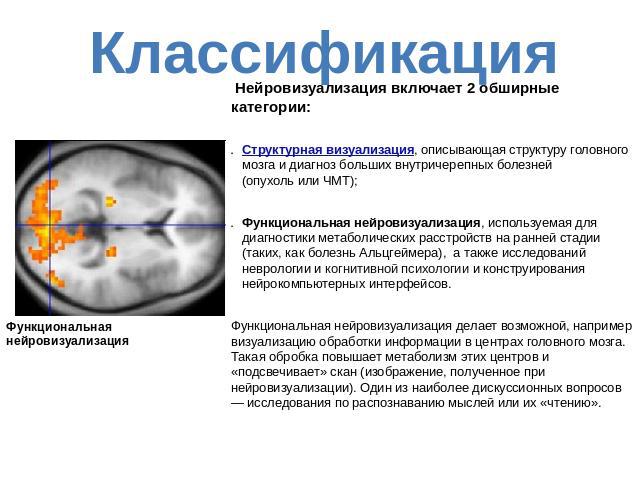 Классификация Нейровизуализация включает 2 обширные категории:Структурная визуализация, описывающая структуру головного мозга и диагноз больших внутричерепных болезней (опухоль или ЧМТ);Функциональная нейровизуализация, используемая для диагностики …