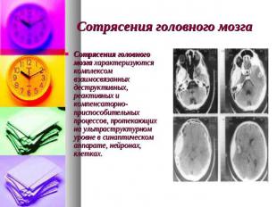Сотрясения головного мозга Сотрясения головного мозга характеризуются комплексом