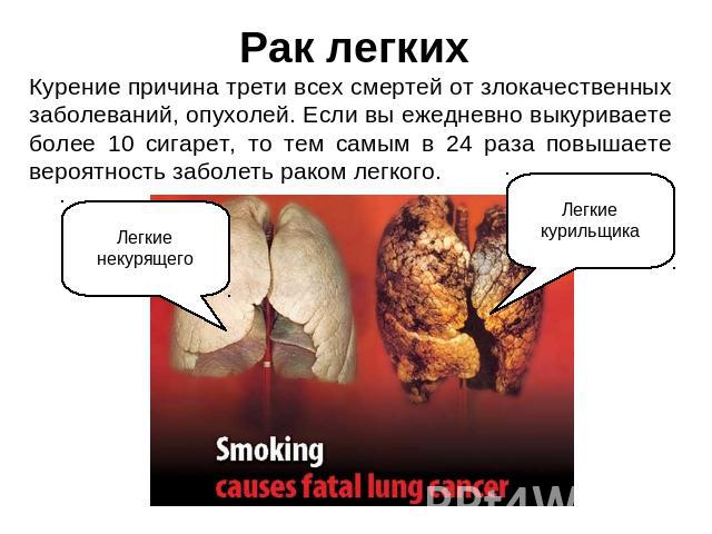 Рак легких Курение причина трети всех смертей от злокачественных заболеваний, опухолей. Если вы ежедневно выкуриваете более 10 сигарет, то тем самым в 24 раза повышаете вероятность заболеть раком легкого. Легкие некурящего Легкие курильщика