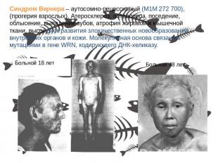 Синдром Вернера – аутосомно-рецессивный (М1М 272 700), (прогерия взрослых). Атер