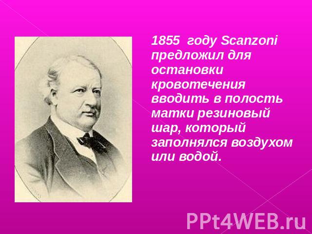 1855 году Scanzoni предложил для остановки кровотечения вводить в полость матки резиновый шар, который заполнялся воздухом или водой.