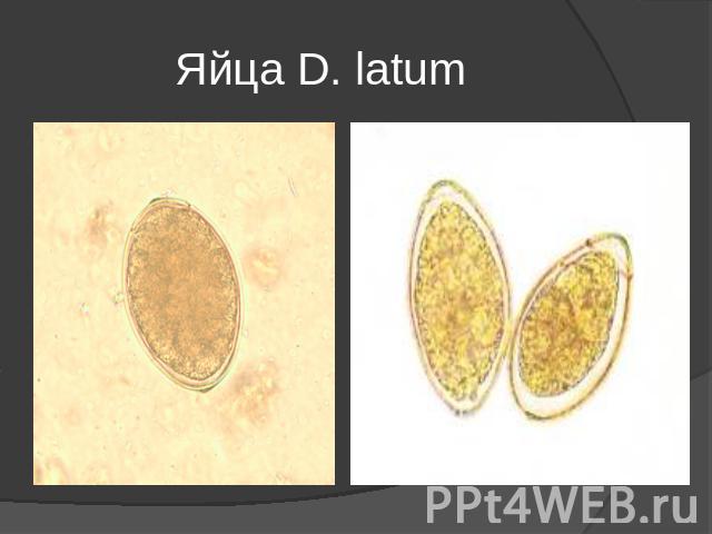 Яйца D. latum