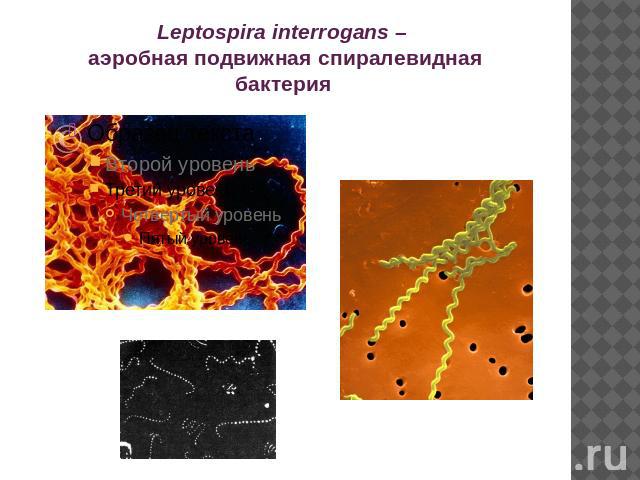 Leptospira interrogans – аэробная подвижная спиралевидная бактерия 