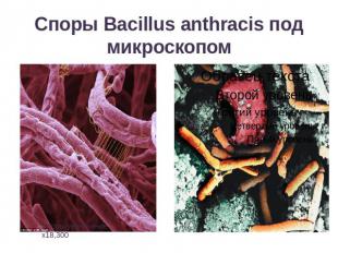 Споры Вacillus anthracis под микроскопом
