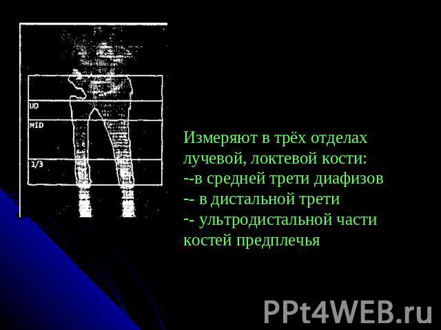 Измеряют в трёх отделах лучевой, локтевой кости: -в средней трети диафизов- в дистальной трети - ультродистальной части костей предплечья