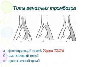 Типы венозных тромбозов а – флоттирующий тромб. Угроза ТЭЛА!б – окклюзивный тром