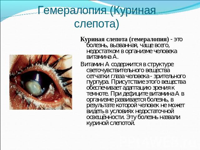 Гемералопия (Куриная слепота) Куриная слепота (гемералопия) - это болезнь, вызванная, чаще всего, недостатком в организме человека витамина А. Витамин А содержится в структуре светочувствительного вещества сетчатки глаза человека - зрительного пурпу…