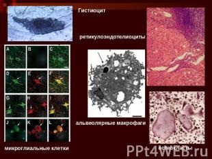 Гистиоцит ретикулоэндотелиоциты альвеолярные макрофаги микроглиальные клетки ост