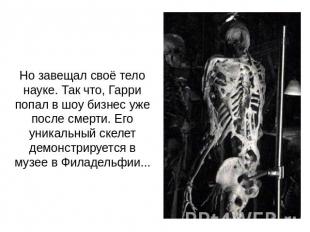 Но завещал своё тело науке. Так что, Гарри попал в шоу бизнес уже после смерти.