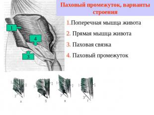 Паховый промежуток, варианты строения 1.Поперечная мышца живота2. Прямая мышца ж