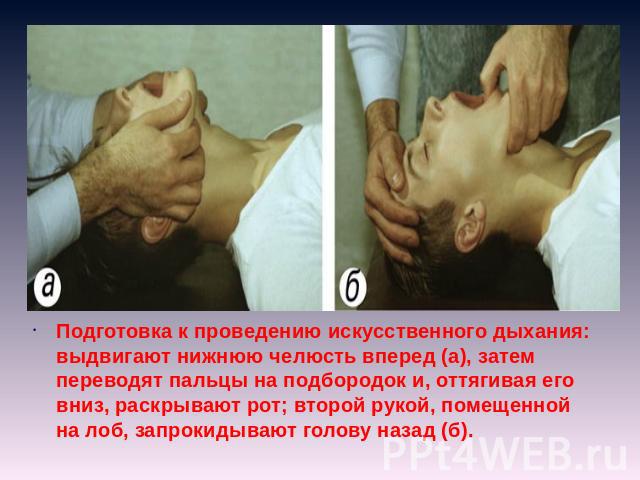 Подготовка к проведению искусственного дыхания: выдвигают нижнюю челюсть вперед (а), затем переводят пальцы на подбородок и, оттягивая его вниз, раскрывают рот; второй рукой, помещенной на лоб, запрокидывают голову назад (б).