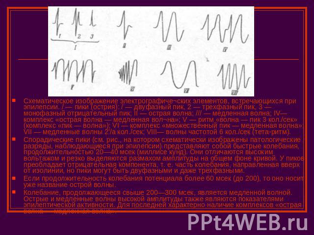 Схематическое изображение электрографиче¬ских элементов, встречающихся при эпилепсии. / — пики (острия): / — двуфазный пик, 2 — трехфазный пик, 3 — монофазный отрицательный пик; II — острая волна; /// — медленная волна; IV— комплекс «острая волна — …