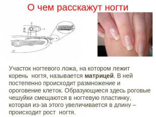 О чем расскажут ногти Участок ногтевого ложа, на котором лежит корень ногтя, наз