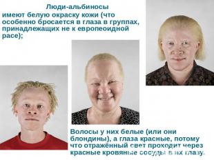 Люди-альбиносы имеют белую окраску кожи (что особенно бросается в глаза в группа