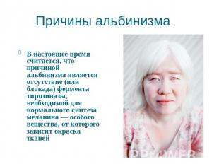 Причины альбинизма В настоящее время считается, что причиной альбинизма является