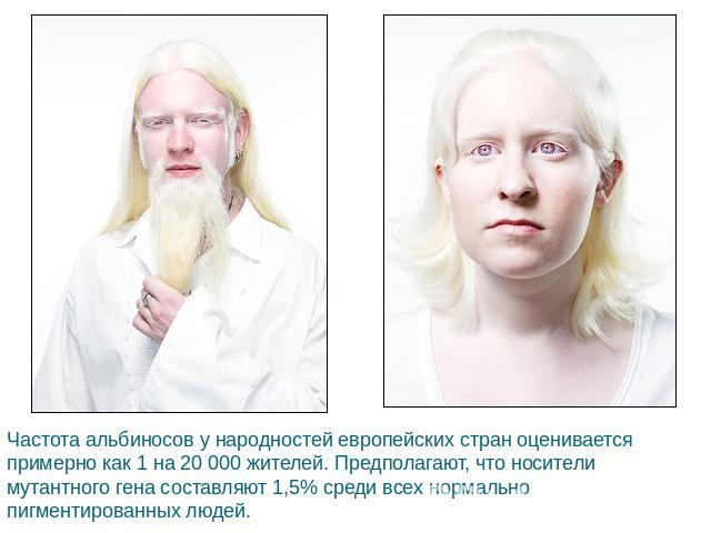 Частота альбиносов у народностей европейских стран оценивается примерно как 1 на 20 000 жителей. Предполагают, что носители мутантного гена составляют 1,5% среди всех нормально пигментированных людей.