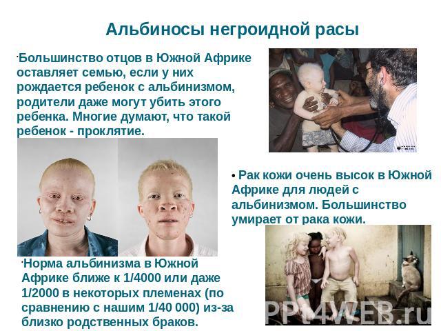 Альбиносы негроидной расы Большинство отцов в Южной Африке оставляет семью, если у них рождается ребенок с альбинизмом, родители даже могут убить этого ребенка. Многие думают, что такой ребенок - проклятие. • Рак кожи очень высок в Южной Африке для …