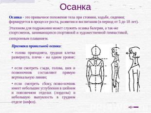 Осанка Осанка - это привычное положение тела при стоянии, ходьбе, сидении; форми