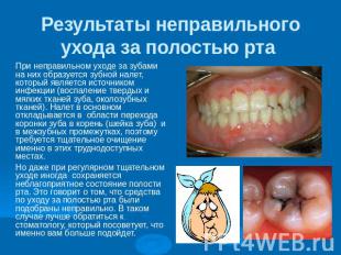 Результаты неправильного ухода за полостью рта При неправильном уходе за зубами