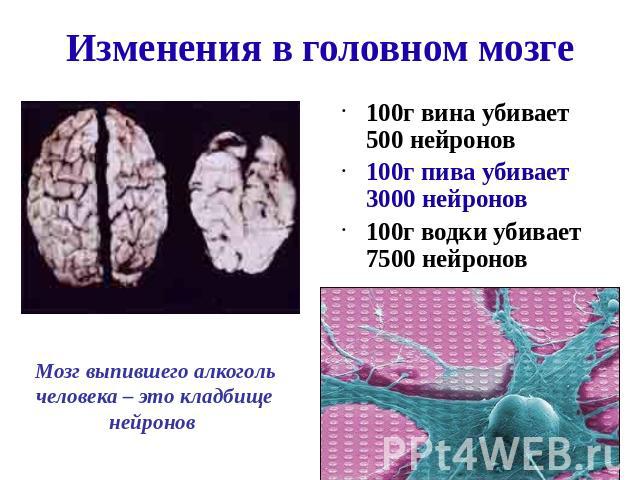 Изменения в головном мозге 100г вина убивает 500 нейронов 100г пива убивает 3000 нейронов 100г водки убивает 7500 нейронов