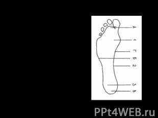 Подошва стопы ноги человека:1 — плюсневая часть; 2 — промежуточная часть; 3 — пя