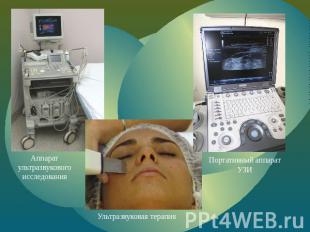 Аппарат ультразвукового исследования Ультразвуковая терапия Портативный аппарат