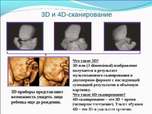 3D и 4D-cканирование 3D-приборы представляют возможность увидеть лицо ребенка ещ