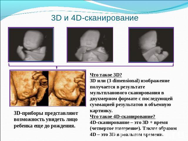 3D и 4D-cканирование 3D-приборы представляют возможность увидеть лицо ребенка еще до рождения. Что такое 3D? 3D или (3 dimensional) изображение получается в результате мультпланового сканирования в двухмерном формате с последующей суммацией результа…