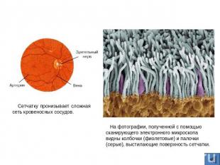 Сетчатку пронизывает сложная сеть кровеносных сосудов. На фотографии, полученной