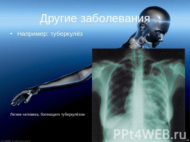 Другие заболевания Например: туберкулёз Легкие человека, болеющего туберкулёзом
