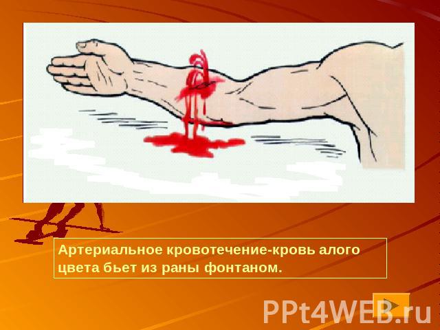 Артериальное кровотечение-кровь алого цвета бьет из раны фонтаном.