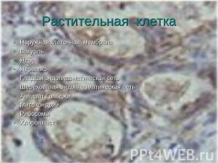 Растительная клетка Наружная клеточная мембранаВакуольЯдроЯдрышкоГладкая эндопла