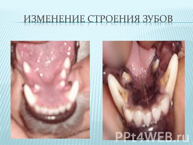 Изменение строения зубов