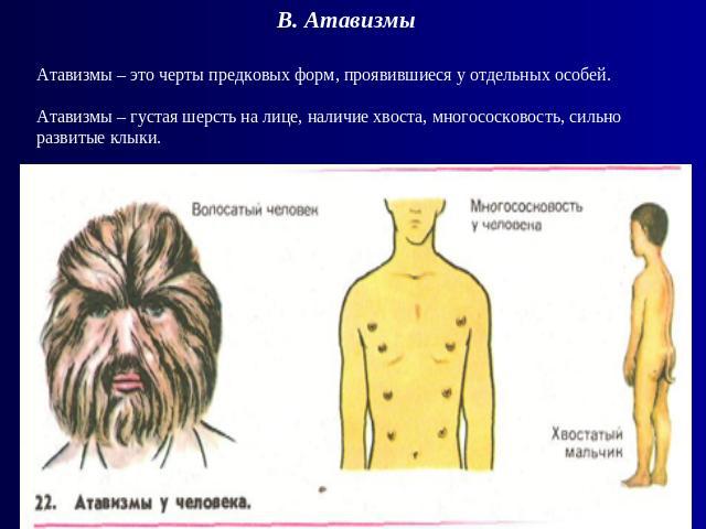 В. Атавизмы Атавизмы – это черты предковых форм, проявившиеся у отдельных особей.Атавизмы – густая шерсть на лице, наличие хвоста, многососковость, сильно развитые клыки.