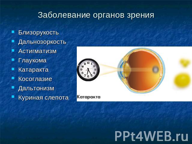 Заболевание органов зрения Близорукость ДальнозоркостьАстигматизмГлаукомаКатарактаКосоглазиеДальтонизмКуриная слепота