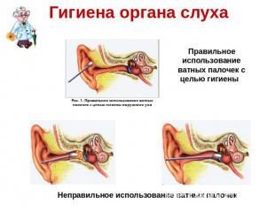 Гигиена органа слуха Правильное использование ватных палочек с целью гигиены Неп