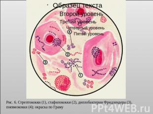 Рис. 6. Стрептококки (1), стафилококки (2), диплобактерии Фридлендера (3), пневм